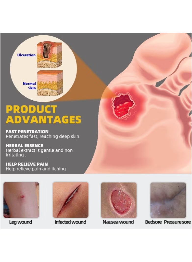 Sumifun Bedsore cream,Pressure Sore Relief Healing Cream for Bed Sores Treatment, Ulcers, Pressure Sores, Wound Healing, Chafed Skin and Hard-to-Heal Skin Sores 20g - Image 3